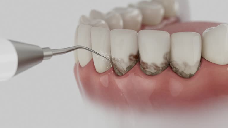 Trusted Dental Crowns And Bridges service in Spring House, PA - Dentist Open Now